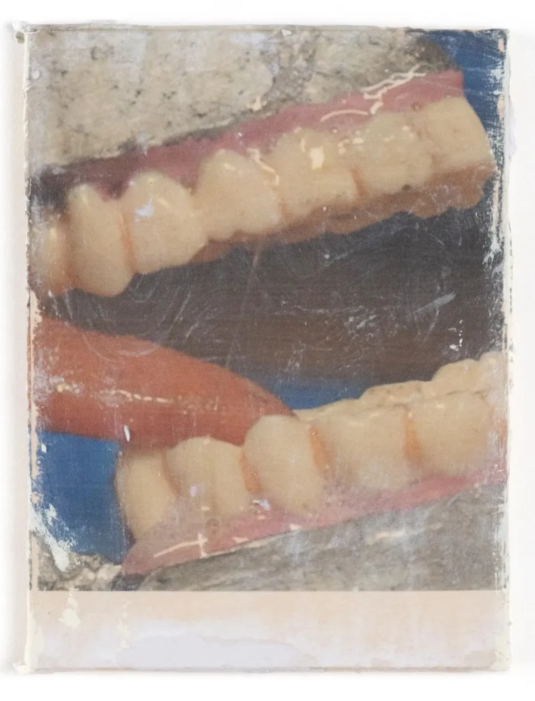 Reliquary (teeth)
